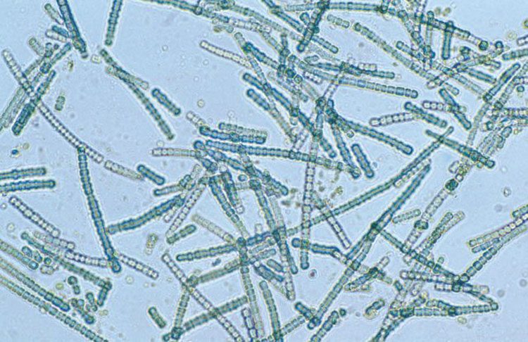 Через миллиард лет на Земле будут жить только бактерии, котрых мы видим под микроскопом